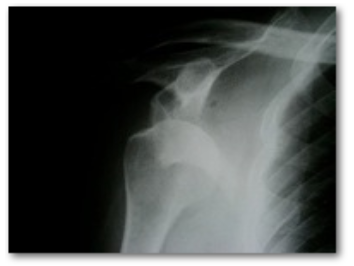 Screen Shot 2015-10-08 at 12.21.39 PM